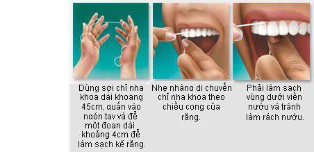 Cách chăm sóc răng miệng hằng ngày
