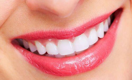 Những tác dụng quan trọng của niềng răng