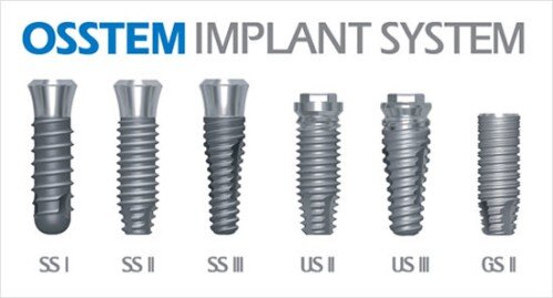 Các loại implant phổ biến nhất hiện nay