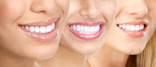 4 cách làm trắng răng hiệu quả tại nhà