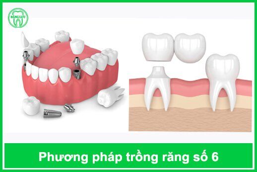 phuong-phap-phuc-hoi-mat-rang