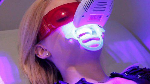 Tẩy trắng răng bằn đèn plasma có khó không ?
