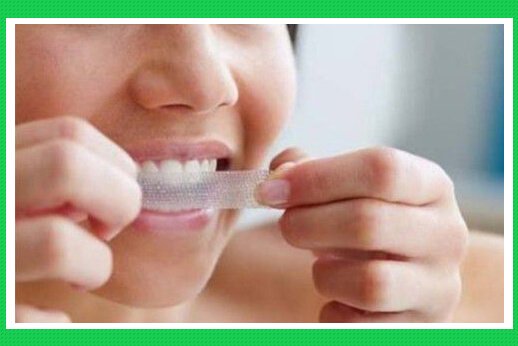 Miếng dán tẩy trắng răng có thật sự tốt?