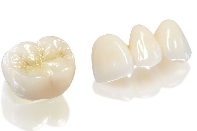 Bạn biết gì về bọc răng sứ Zirconia?
