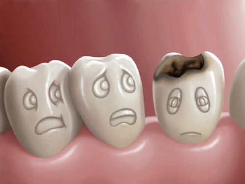 Bệnh lý của răng