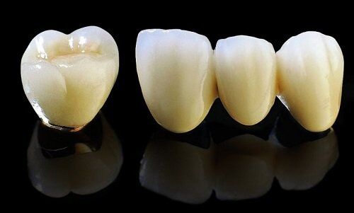 Bọc răng sứ kim loại có bị xỉn màu không?