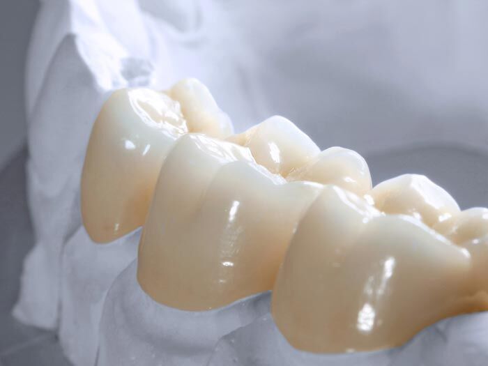 Bọc răng sứ Zirconia cao cấp ở TP.HCM