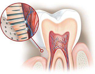 Các giải pháp giúp cải thiện tình trạng răng ê buốt