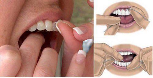 các vấn đề chăm sóc răng miệng cơ bản nhất