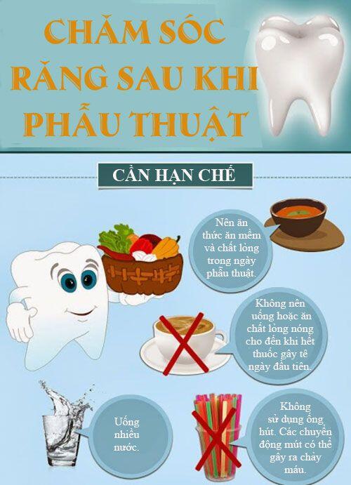 cách chăm sóc răng cấy ghép