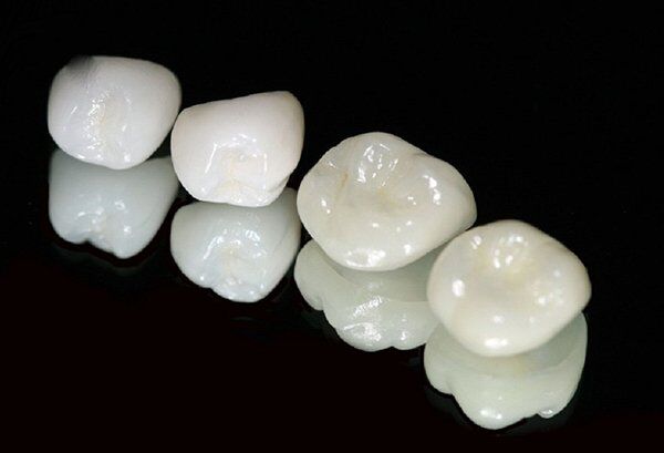 Cách chăm sóc răng sứ Cercon HT để tăng tuổi thọ của răng sứ
