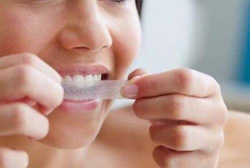 cách sử dụng miếng dán trắng răng tại nhà