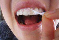 Cách sử dụng miếng dán trắng răng tại nhà