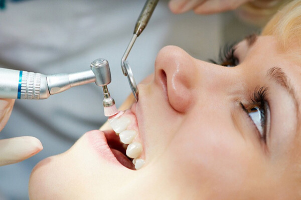 Làm gì để phòng ngừa sự hình thành cao răng hiệu quả?