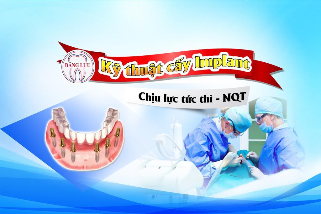 cay-implant-chiu-luc-tuc-thi-2