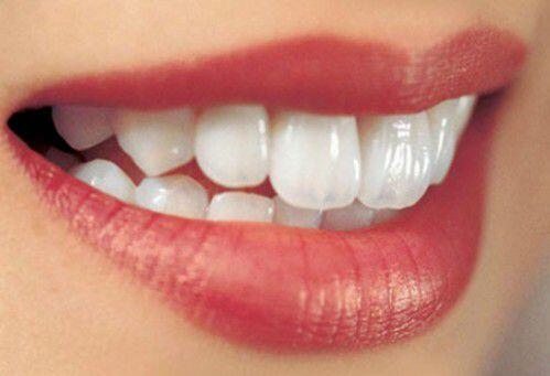 Cách làm trắng răng an toàn