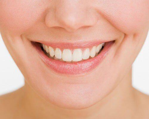lợi ích của việc nắn chỉnh răng