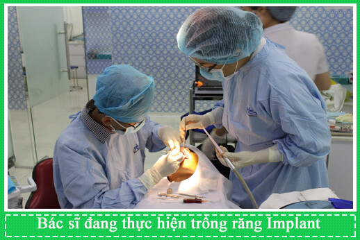 nha-khoa-can-tho-implant-1