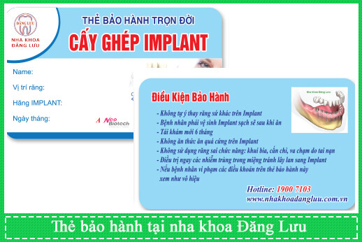 nha-khoa-can-tho-implant-2