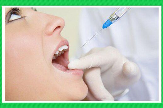 Quy trình điều trị tủy răng và cách chăm sóc răng sau điều trị tủy