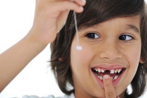 Nhổ răng cho trẻ em