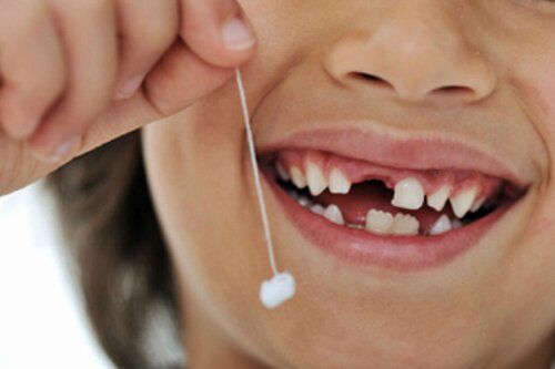 Nhổ răng sữa sớm có hại không