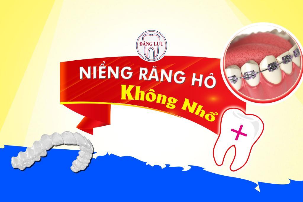 nieng-rang-khong-nho-rang-1