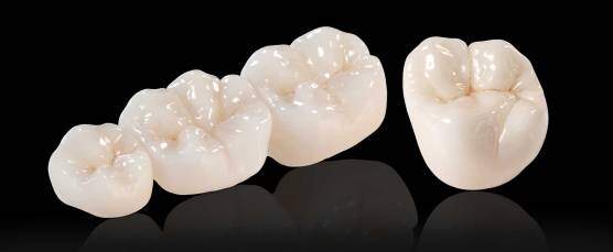 Bọc răng sứ Zirconia được thực hiện ra sao?