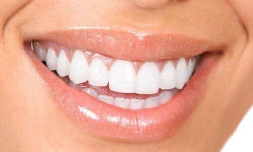 Răng đẹp cần đạt những tiêu chuẩn nào