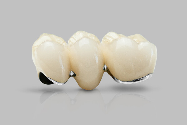 Chăm sóc răng sứ Titan như thế nào để giữ độ bền chắc?
