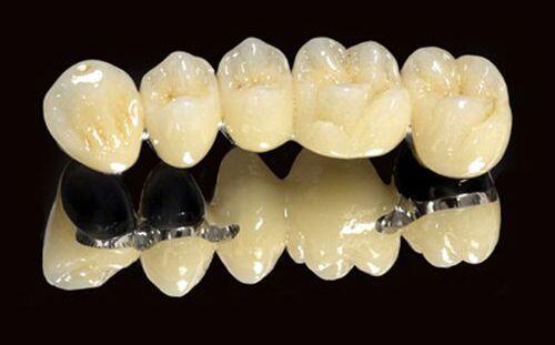 Phương pháp phục hình cho răng chết tủy