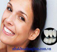 Răng sứ kim loại thường có tốt không ?
