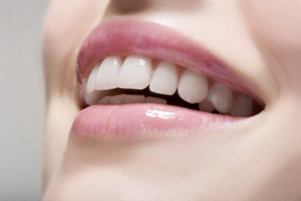Răng sứ kim loại và răng toàn sứ có gì khác nhau?