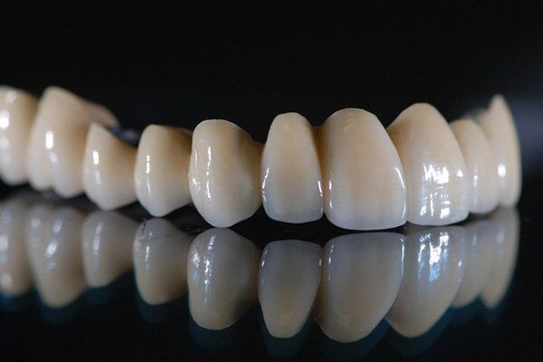 răng sứ Titan