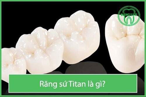 Răng sứ Titan là gì ? 1