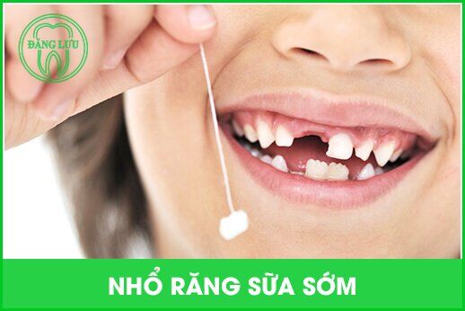 Răng sữa xấu có ảnh hưởng tới răng cố định