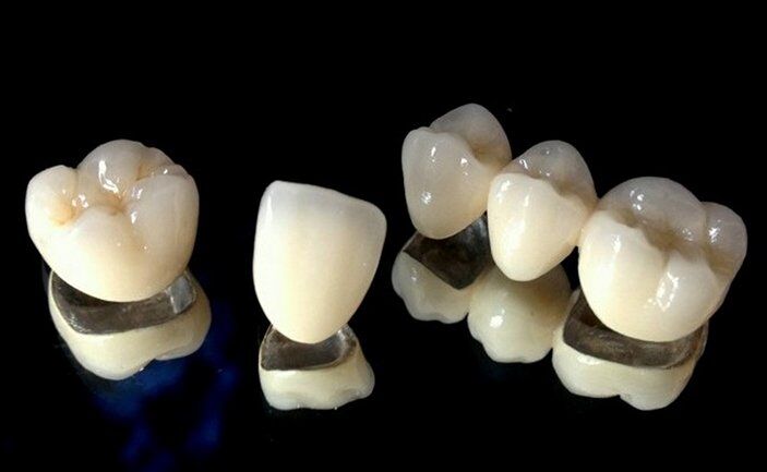 ưu điểm của răng sứ titan