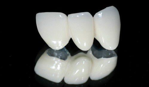 Làm trắng răng có hại như thế nào ?