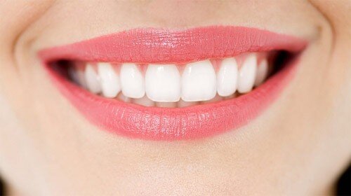 Tẩy trắng răng và lấy cao răng có giống nhau