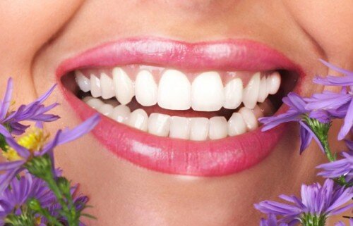 Tẩy trắng răng và lấy cao răng có giống nhau