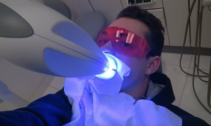 tẩy trắng răng công nghệ Laser