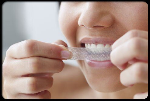Có nên tự tẩy trắng răng tại nhà không ?