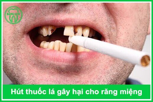 Thuốc lá gây ra nhiều chứng bệnh về răng miệng