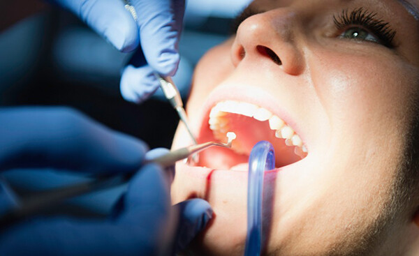 Những nguyên nhân làm hại men răng