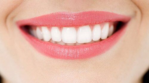 Tuổi thọ của răng sứ Cercon kéo dài trong bao lâu?