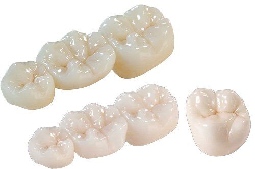 Ưu điểm vượt trội của răng sứ Cercon Zirconia là gì?