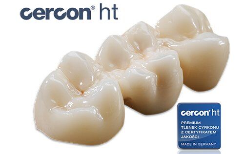 Ưu và nhược điểm của răng sứ Cercon HT?