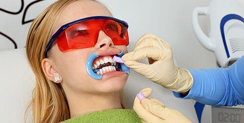 Lấy cao răng nhiều lần có tốt không ?