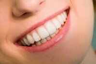 Tẩy trắng răng bằng phương pháp chiếu đèn kết hợp thuốc tẩy